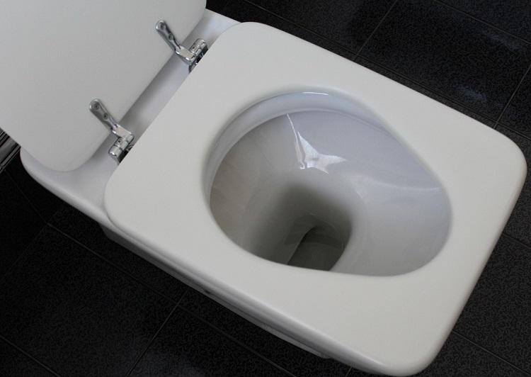 Sararan Klozet Nasıl Temizlenir